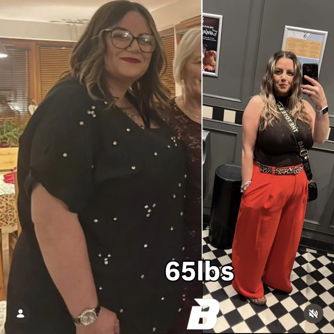 65 lb lost. Before and after, shown side by side.